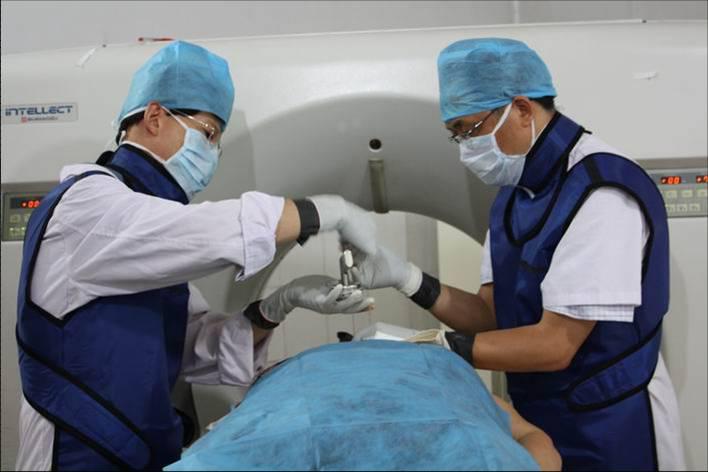 碘125放射性粒子植入术